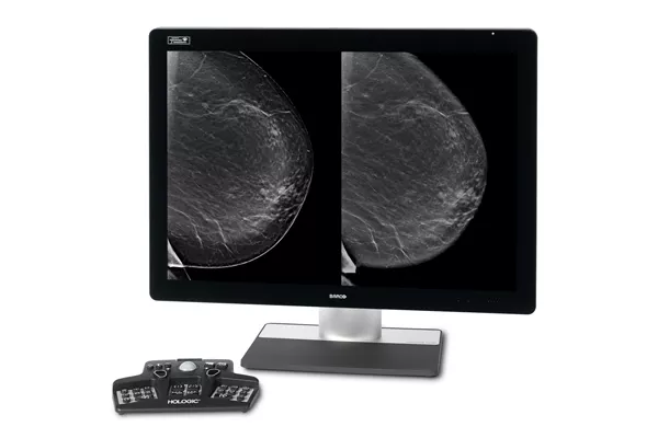 Monitor showing breast scans with controller